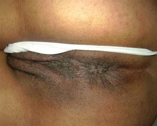 African Woman Anus