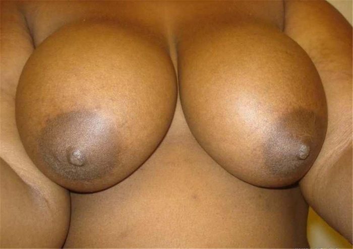 african-tits-anyone