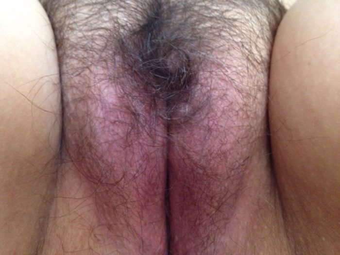 fat hairy vagina close up 2