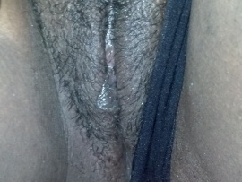 flashing-black-outer-labia-close-up