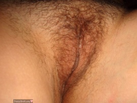 hairy-vulva-lips-up-close