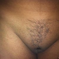indian pussy mound standing