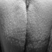 outer-labia-close-up