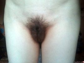 vulva-fully-covered-with-hair