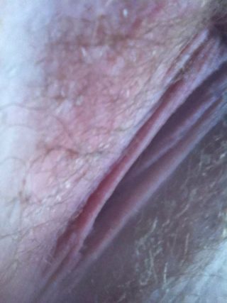 vulva lips close up