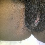 weird dense african pubic hair