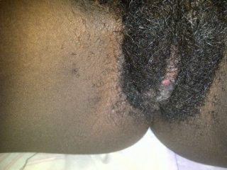 weird dense african pubic hair