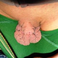 weirdest pussy labia huge